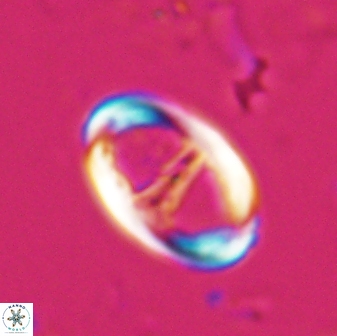 Zygodiscus cearae 25504