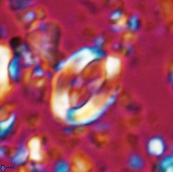 Zygodiscus clausus 23436
