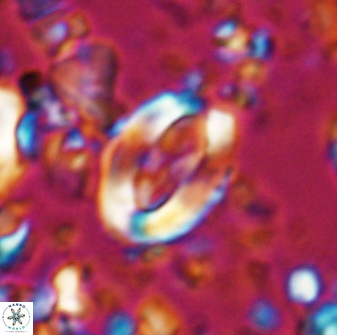Zygodiscus clausus 23436