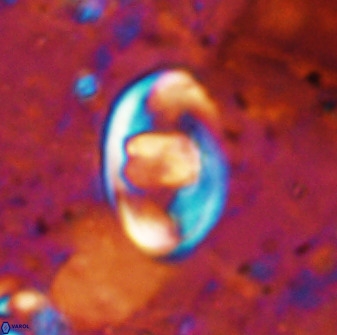 Zygodiscus herlyni 50031