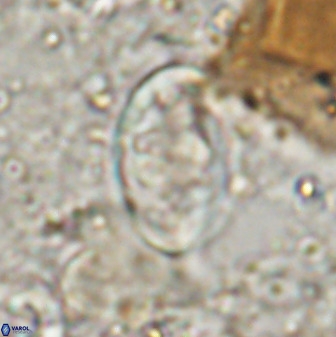 Zygodiscus herlyni 50035