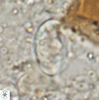 Zygodiscus herlyni 50035