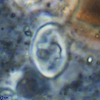 Zygodiscus herlyni 50036