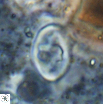 Zygodiscus herlyni 50036