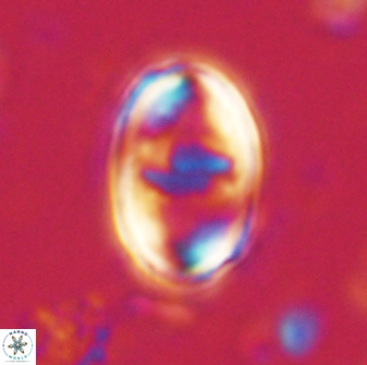 Zygodiscus herlyni 60792
