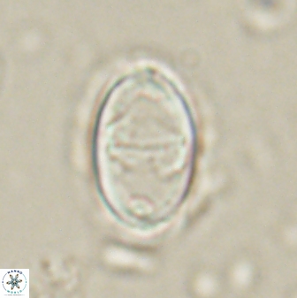 Zygodiscus herlyni 60799