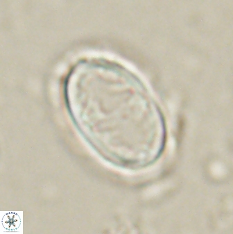 Zygodiscus herlyni 60801