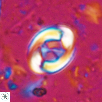 Zygodiscus segmentatus 24956
