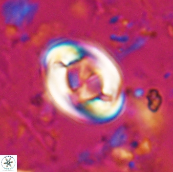Zygodiscus segmentatus 24960