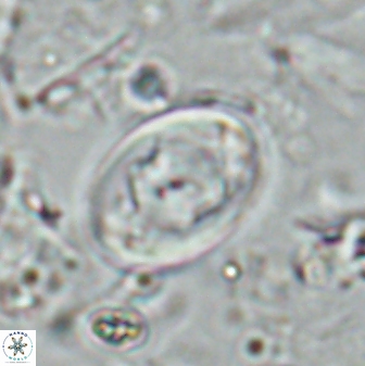 Zygodiscus segmentatus 24962