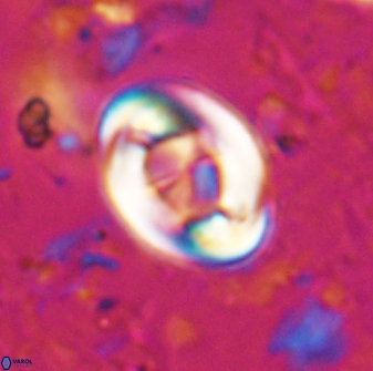 Zygodiscus segmentatus 25029