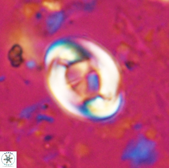 Zygodiscus segmentatus 25029