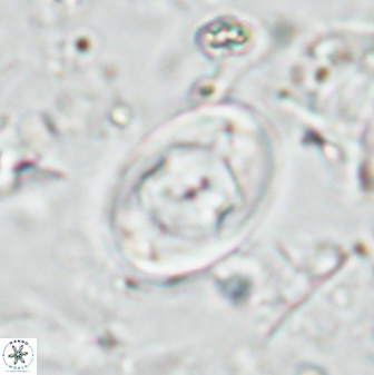 Zygodiscus segmentatus 25034
