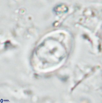 Zygodiscus segmentatus 25035