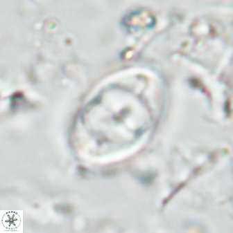 Zygodiscus segmentatus 25035
