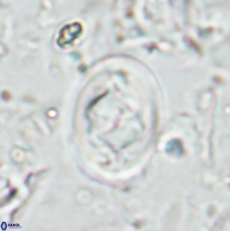 Zygodiscus segmentatus 25036