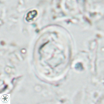 Zygodiscus segmentatus 25036