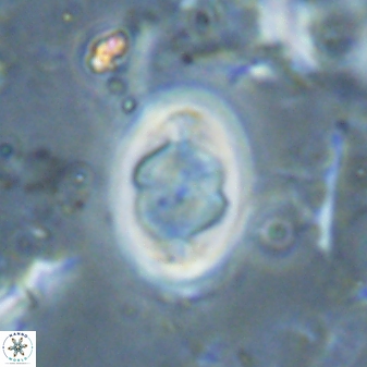 Zygodiscus segmentatus 25037
