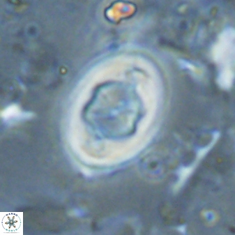 Zygodiscus segmentatus 25038