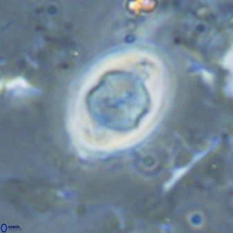 Zygodiscus segmentatus 25039