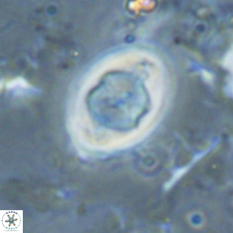 Zygodiscus segmentatus 25039