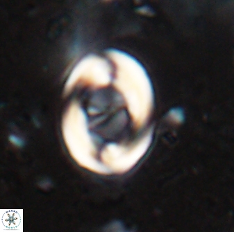 Zygodiscus segmentatus 25030