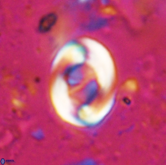 Zygodiscus segmentatus 25031