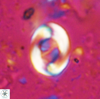 Zygodiscus segmentatus 25031