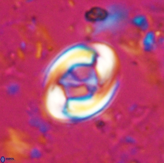 Zygodiscus segmentatus 25032