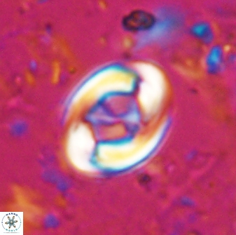 Zygodiscus segmentatus 25032