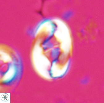 Zygodiscus segmentatus 25758