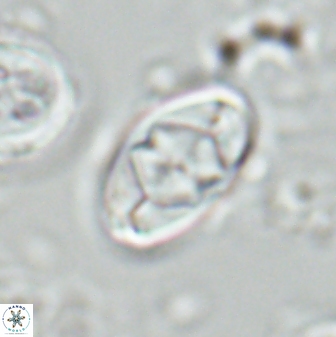 Zygodiscus segmentatus 25764