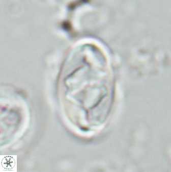 Zygodiscus segmentatus 25763
