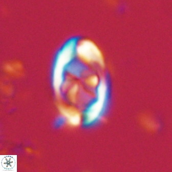 Zygodiscus segmentatus 20046