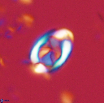Zygodiscus segmentatus 20051