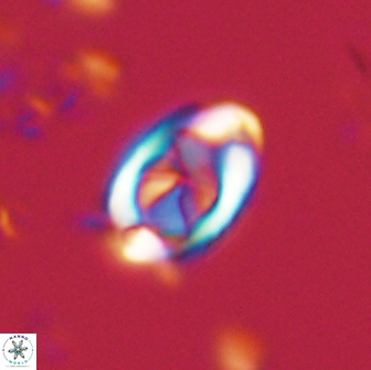 Zygodiscus segmentatus 20051