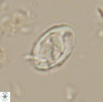 Zygodiscus segmentatus 20053