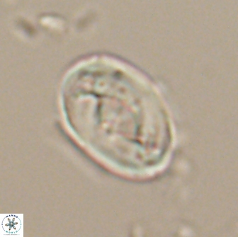Zygodiscus segmentatus 20214