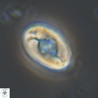 Zygodiscus segmentatus 20215