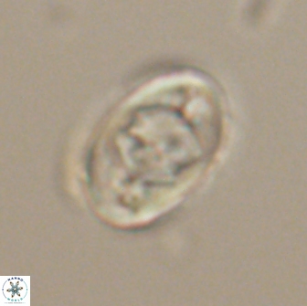 Zygodiscus segmentatus 20239