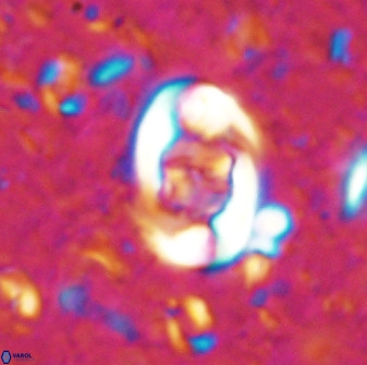 Zygodiscus segmentatus 48885