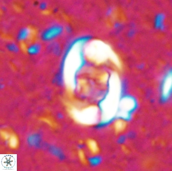 Zygodiscus segmentatus 48885