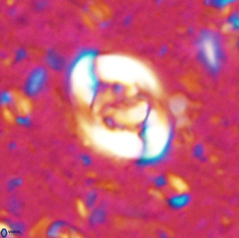 Zygodiscus segmentatus 48886