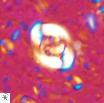 Zygodiscus segmentatus 48886