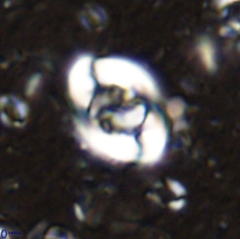 Zygodiscus segmentatus 48887