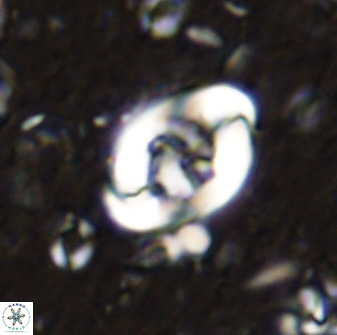 Zygodiscus segmentatus 48888