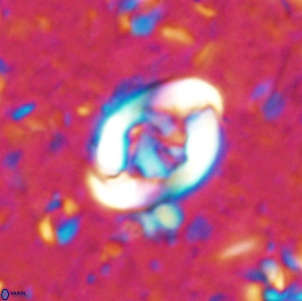 Zygodiscus segmentatus 48889