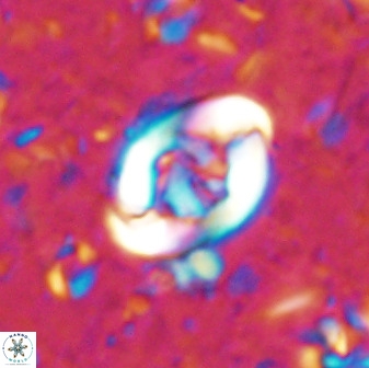 Zygodiscus segmentatus 48889