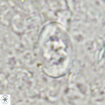 Zygodiscus segmentatus 48890