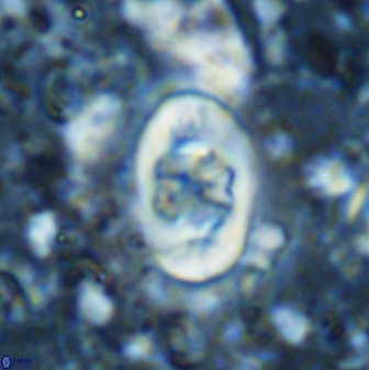 Zygodiscus segmentatus 48891